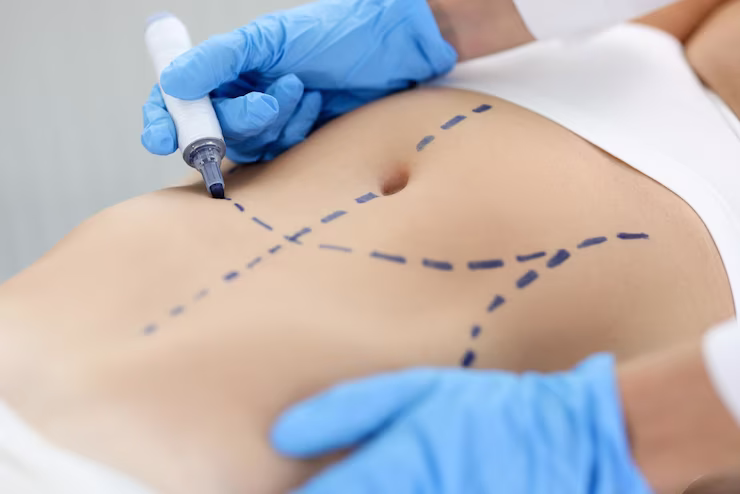 Bölgesel İncelme,www.samiraguzelliksalonu.com